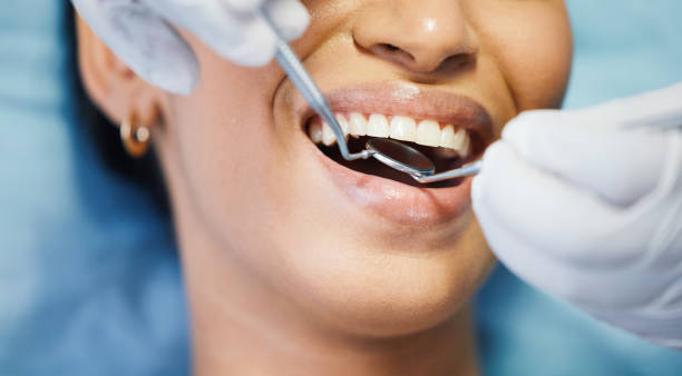 Best Urgent Care for Lost Fillings or Crowns in Lake Station, IN
