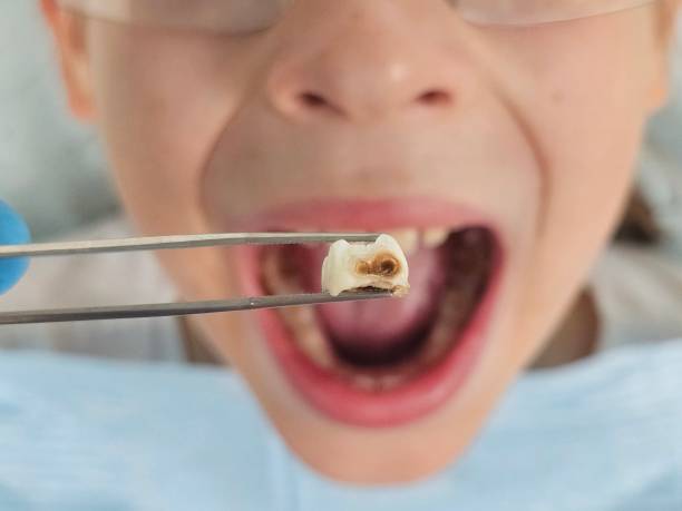 Best Weekend Emergency Dentist in Lake Station, IN